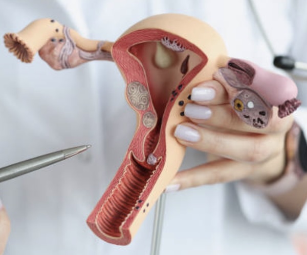 Gynaecology Disorders