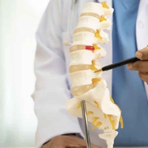 Lumbar Spondylosis treatment