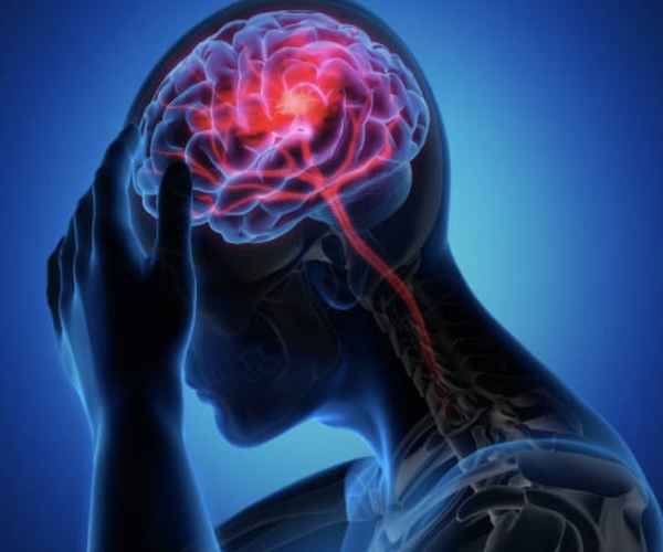 Neurological Disorders