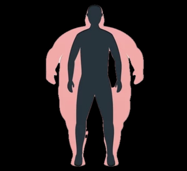 Obesity treatment