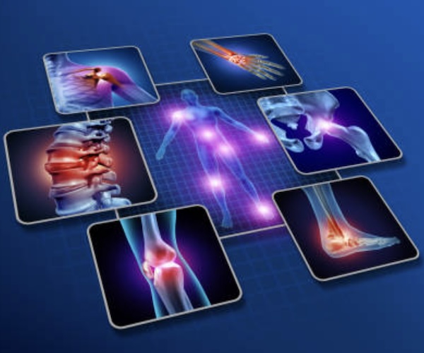 Orthopaedic Disorders