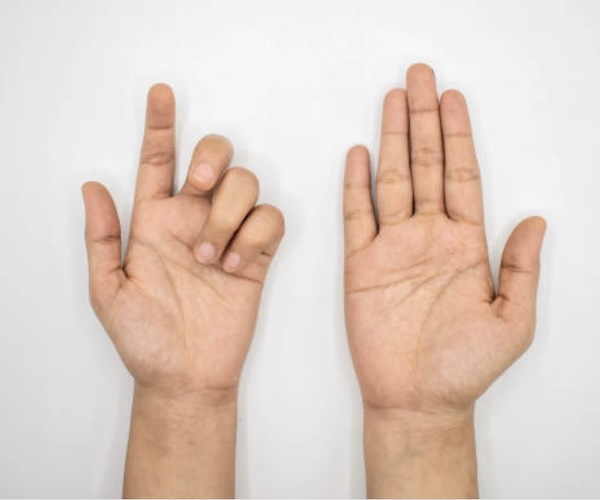 Obesity treatment