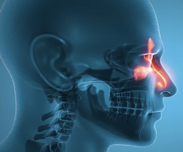 Sinusitis treatment